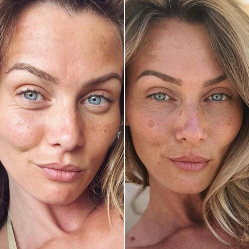 Eye Therapy photo review