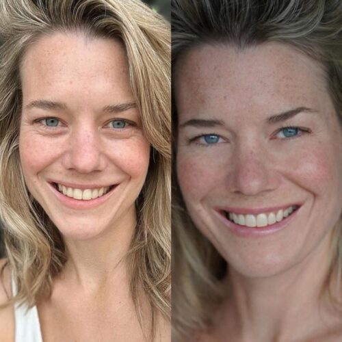 Eye Therapy photo review