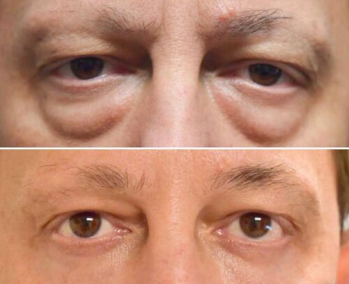 Eye Therapy photo review