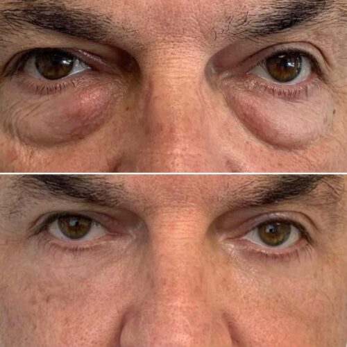 Eye Therapy photo review