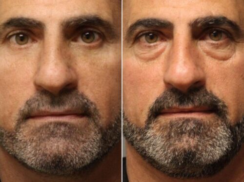 Eye Therapy photo review