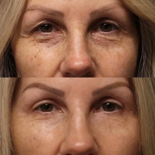 Eye Therapy photo review